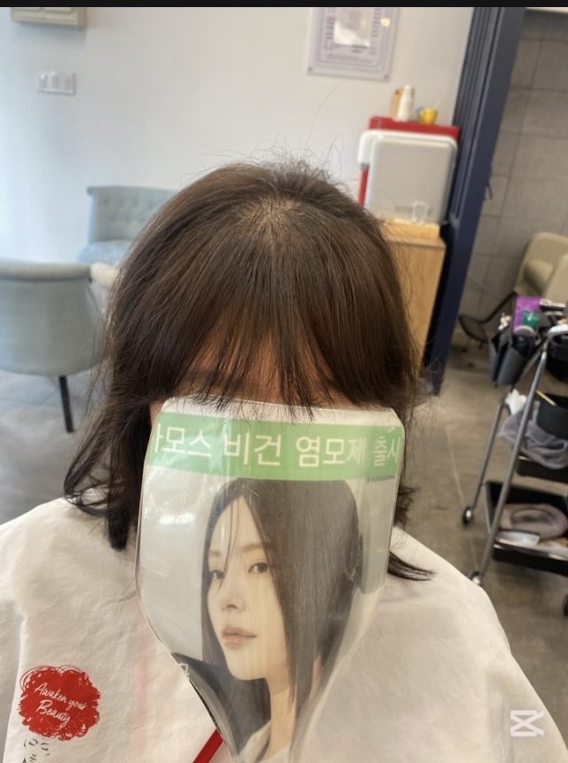 시술 후 — 모류교정펌